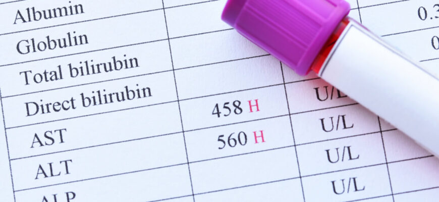 Что это значит и как снизить